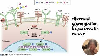 Aberrant Glycosylation in pancreatic cancer Code 343 [upl. by Eiramnna]