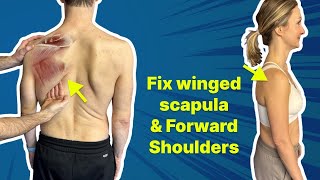 The 1 Exercise to Fix Winged Scapula amp Forward Shoulder  GET OUT of PAIN [upl. by Sylvan]