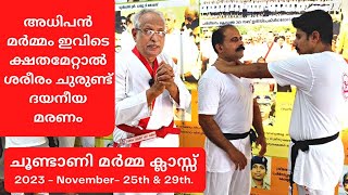 അധിപൻമർമ്മം ഇവിടെ ക്ഷതമേറ്റാൽ ശരീരം ചുരുണ്ട് ദയനീയ മരണം [upl. by Hewet]