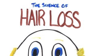 The Science of Hair LossBalding [upl. by Yesdnik309]