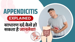 Appendicitis in Hindi  Causes Karan Symptoms Tests Lecture amp Treatment  Appendix Kya Hota Hai [upl. by Harrie]