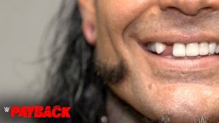 Jeff Hardy receives medical attention for his broken tooth Exclusive April 30 2017 [upl. by Oiralednac]