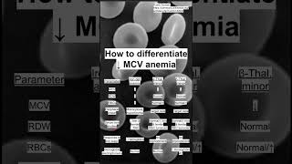 How to differentiate ↓ MCV anemia [upl. by Lisetta806]