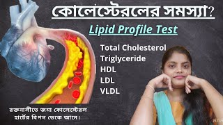 Lipid Profile Test In Bengali  Cholesterol Test Bangla Cholesterol Triglyceride HDL LDL VLDL [upl. by Yuille498]