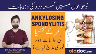 Ankylosing Spondylitis In Urdu  Kamar Dard Ka Fori Ilaj  Ankylosing Spondylitis Symptoms Treatment [upl. by Evita28]