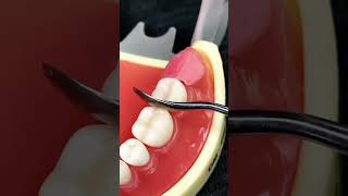 How to fill the gap after removing the corner teeth in the mouth shortvideo newbornbaby dentalcar [upl. by Nawaj9]