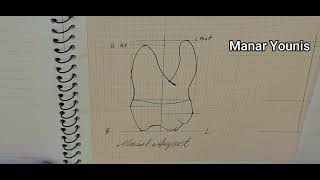 Drawing Maxillary Right first Molar Part 2 mesial distal and occlusal aspects [upl. by Najram77]