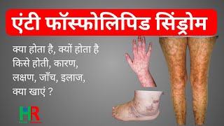 Anti Phospholipids syndrome in hindi  एंटी फॉस्फोलिपिड सिंड्रोम किसे क्यों क्या कैसे होता है [upl. by Ahearn480]