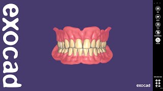 exocad Video Tutorial Full Denture Design [upl. by Rhtaeh]