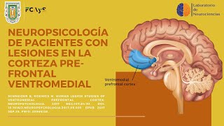 Neuropsicología de pacientes con lesiones en la Corteza PreFrontal Ventromedial [upl. by Tricia23]