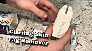 Claritag Skin Tag Remover Review FDA Approved [upl. by Rebmak]