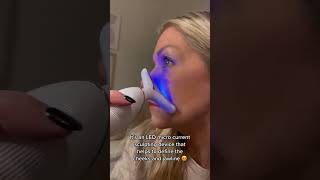 Facial Lifting Device Achieve a Youthful Glow with Advanced Technology [upl. by Caryn944]