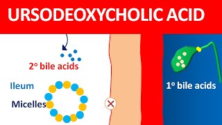 Ursodeoxycholic acid udca for biliary cirrhosis and gallstones [upl. by Aronas658]