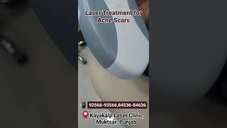 Acne Scar Removal  Face Laser Treatment [upl. by Tips149]