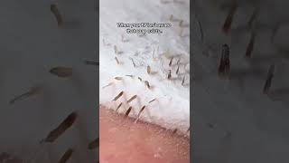 I knew that peeling would be good 🫠 explorepage satisfying skincaretip [upl. by Salohcim]