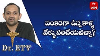 Can Crooked Toes Be Fixed వంకరగా ఉన్న కాళ్ళ వేళ్ళు సరిచేయవచ్చా DrETV  12th May 2023  ETV Life [upl. by Einad822]