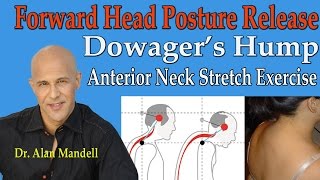 Forward Head Posture Release Dowagers Hump Anterior Neck Stretches  Dr Mandell [upl. by Hillier187]