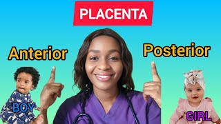 Anterior placenta boy or girl posterior placenta baby gender [upl. by Kachine235]