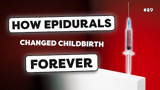 Epidural Everything You Need to Know [upl. by Anined916]