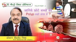 जानिये छोटे बच्चों को Polyp कहाँ होता है   Polyp part 2  DrVKMishra MD DM Gastro [upl. by Nalhsa50]