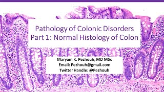 Pathology of Colonic Disorders Part1 Normal Histology of Colon [upl. by Ahtnicaj252]