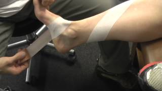 Antipronation taping Leukotape [upl. by Londoner281]