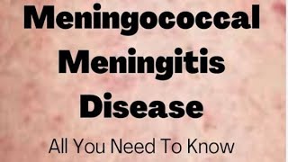 Meningococcal meningitis  social pharmacy 1st year d pharmacy pharmacist biology pharmacy neet [upl. by Barbe]