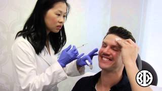 Botox to treat crows feet and frown lines [upl. by Ainevul904]