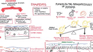 Asthma  signs and symptoms pathophysiology [upl. by Lathe856]