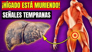 🚨 ¡8 Signos de que Tu Hígado ESTÁ MURIENDO ¡NO LAS IGNORES 🚨 [upl. by Narra59]