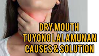 Tuyong Lalamunan Causes amp Solution Dry mouth Xerostomia Pinoy Healthy Lifestyle [upl. by Herzel]