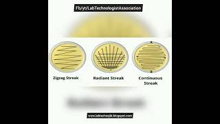 What is StreakPlateMethod [upl. by Cole]