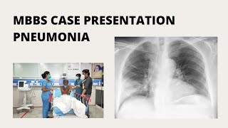 CSOM Clinical case presentation [upl. by Kissner]