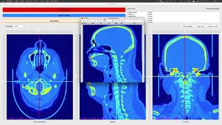 Dicom Viewer Project – 3D Processing Demo [upl. by Novyar950]