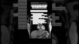 Respiratory effects of volatile anesthetics [upl. by Marthe]