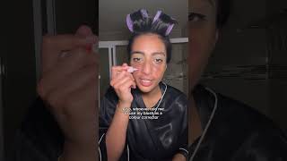 GRWM scalp eczema  eczema scars [upl. by Auhsuoj]