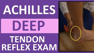 Achilles Heel Deep Tendon Reflex Test  Nursing Head to Toe Assessment [upl. by Ahsieka251]