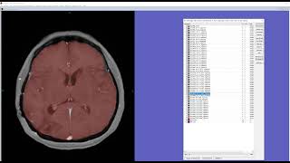 Multiprotocol brain registration and Intensity calibration Rigid version [upl. by Edea]