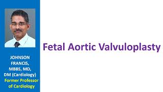 Fetal aortic valvuloplasty [upl. by Ahcsap561]