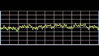 Vitiligo  Rife Frequencies [upl. by Licht]