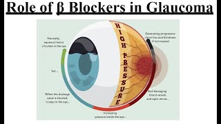 Beta blockers in Glaucoma PowerPoint presentation [upl. by Garfield]