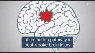 cGAScGAMPSTING signaling mediates brain injury after subarachnoid hemorrhage [upl. by Uhsoj]