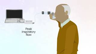 Easyhaler dry powder inhaler in patients with COPD [upl. by Hubing209]