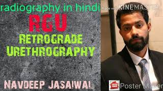 Retrograde urethrography RGU  radiography in hindi [upl. by Varney]