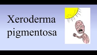 Xeroderma pigmentosum XP [upl. by Henleigh]