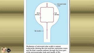 ECG tutorial Basic principles of ECG analysis Pediatric ECG 006 [upl. by Enner]