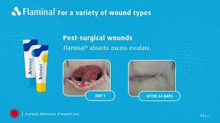 Introducing Flaminal®  effective wound care for acute and chronic wounds [upl. by Ahsrav]