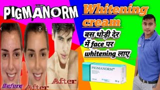 whitening cream pigmanorm इस्तेमल कैसे करे जानिए। [upl. by Hallsy281]