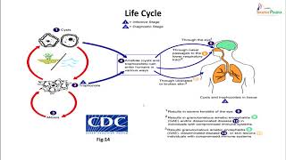 47 Parasites infecting the CNS [upl. by Teevens]