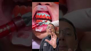 NEW Teeth Whitening InOffice Procedure Explained  In Office to Hands On Dental Training [upl. by Arremat]